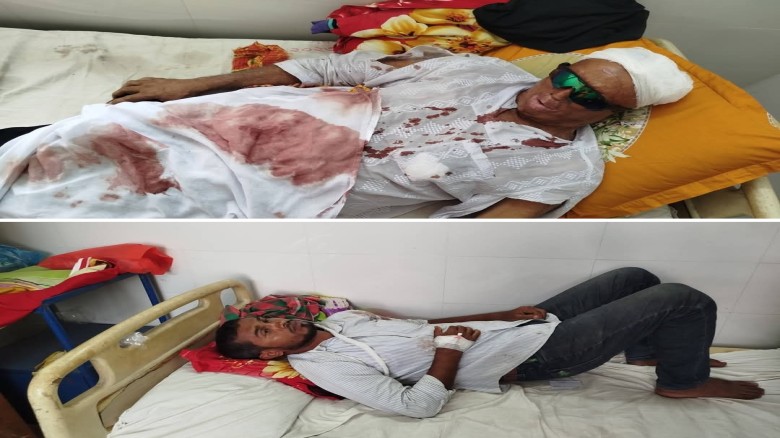 গোপালগঞ্জে সাবেক ইউপি চেয়ারম্যানের ওপর হামলা, আহত ২
