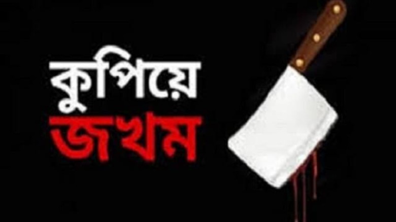 রূপগঞ্জে পূর্বশত্রুতার জেরে ৩জনকে কুপিয়ে জখম,থানায় মামলা